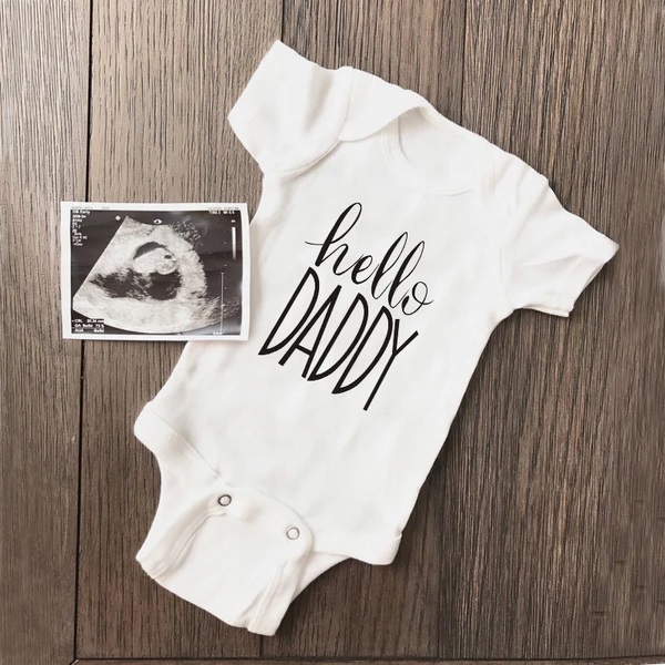 Baby Clothing Online - Verão bebê recém-nascido da menina do